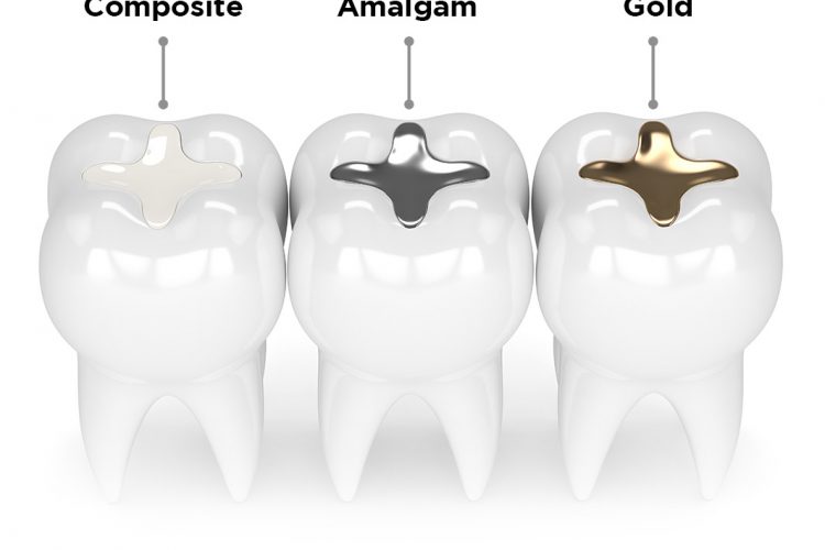 مراقبت های بعد از ترمیم دندان