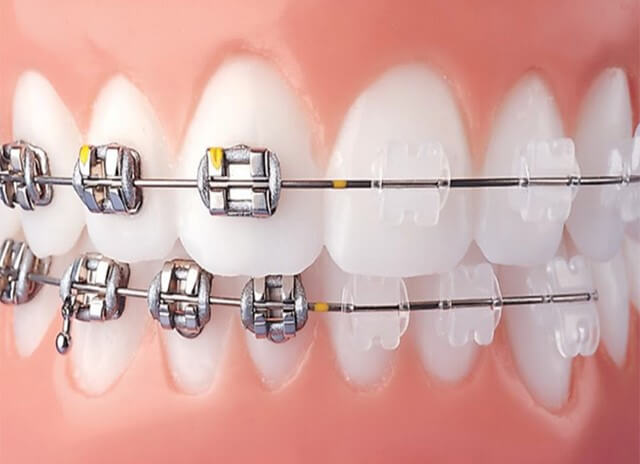 دندانپزشکی من دندانپزشکی تخصصی (مای دنتینیک)،‌ خالق لبخندی زیبا | پیشرفته ترین دندانپزشکی ایران | My Dentistry Clinic