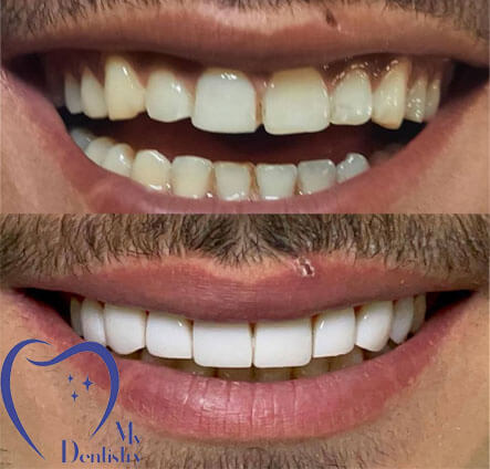 دندانپزشکی من دندانپزشکی تخصصی (مای دنتینیک)،‌ خالق لبخندی زیبا | پیشرفته ترین دندانپزشکی ایران | My Dentistry Clinic